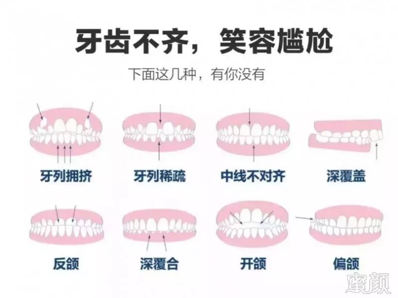 https://img.miyanlife.com/mnt/timg/180724/121K24H2-0.jpg