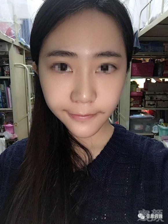 https://img.miyanlife.com/mnt/timg/180724/121RG1X-2.jpg