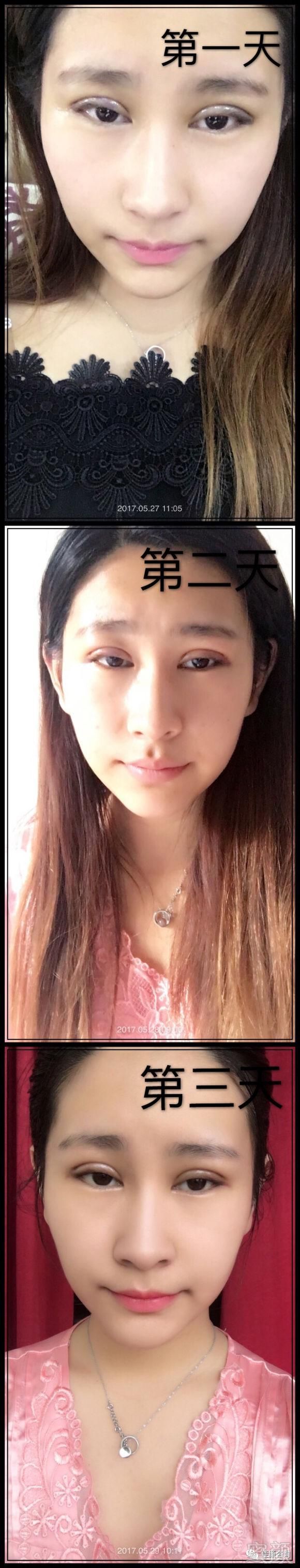 https://img.miyanlife.com/mnt/timg/180724/1226014044-2.jpg