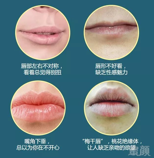 https://img.miyanlife.com/mnt/timg/180724/12263M610-4.jpg