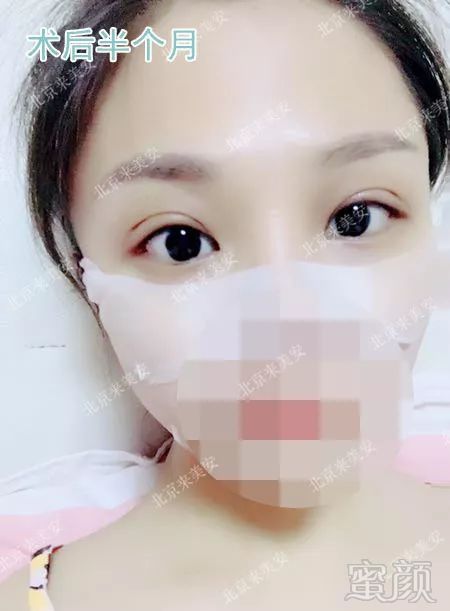 https://img.miyanlife.com/mnt/timg/180724/12291C3O-4.jpg