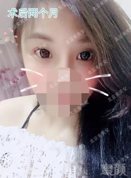 https://img.miyanlife.com/mnt/timg/180724/12291M5K-6.jpg