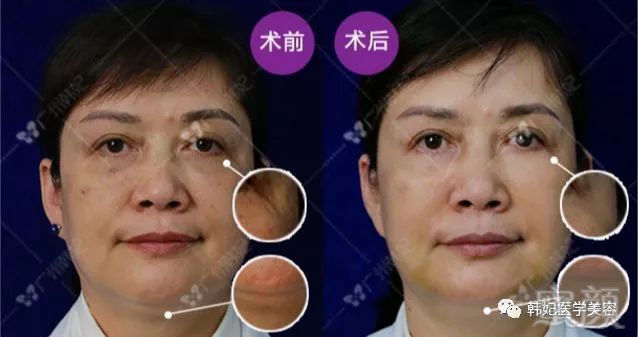 https://img.miyanlife.com/mnt/timg/180724/12312a2a-12.jpg