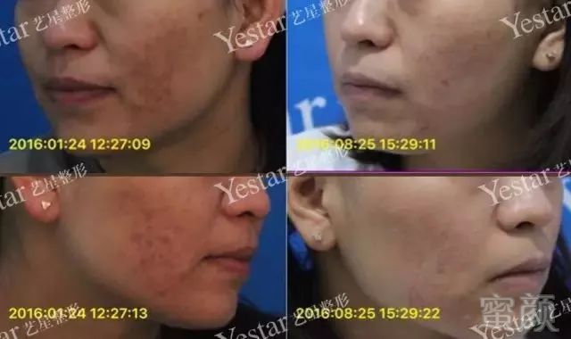https://img.miyanlife.com/mnt/timg/180724/1234002U2-6.jpg