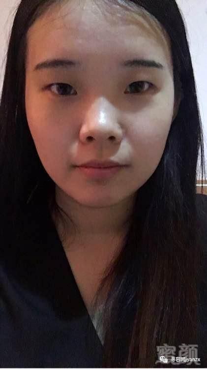 https://img.miyanlife.com/mnt/timg/180724/1241031437-0.jpg