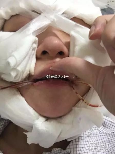 https://img.miyanlife.com/mnt/timg/180724/12494V4M-15.jpg