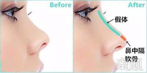 https://img.miyanlife.com/mnt/timg/180724/124G1G52-2.jpg