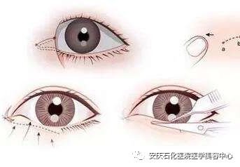 https://img.miyanlife.com/mnt/timg/180724/125442N37-2.jpg