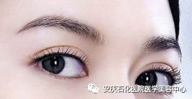 https://img.miyanlife.com/mnt/timg/180724/1254432920-4.jpg