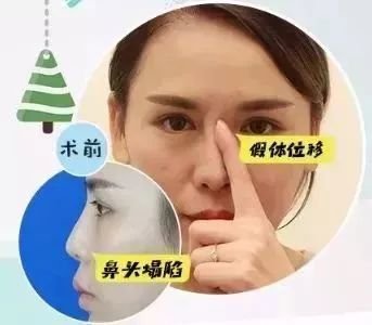 https://img.miyanlife.com/mnt/timg/180724/125IV242-2.jpg