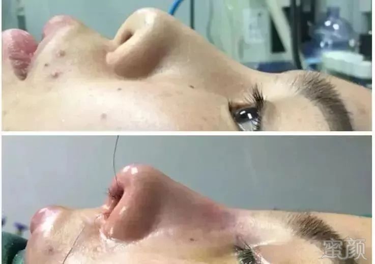 https://img.miyanlife.com/mnt/timg/180724/125Ia616-4.jpg