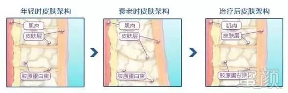 https://img.miyanlife.com/mnt/timg/180724/125T42392-4.jpg