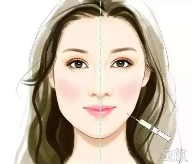 https://img.miyanlife.com/mnt/timg/180725/11194125X-1.jpg