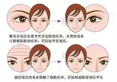 https://img.miyanlife.com/mnt/timg/180725/1119424145-6.jpg