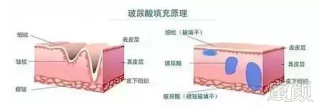 https://img.miyanlife.com/mnt/timg/180725/11194329A-7.jpg