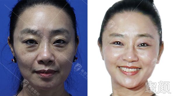 https://img.miyanlife.com/mnt/timg/180725/111943F35-8.jpg