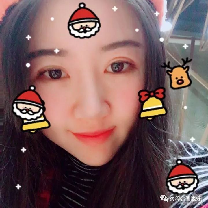 https://img.miyanlife.com/mnt/timg/180725/1131521353-5.jpg