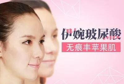 https://img.miyanlife.com/mnt/timg/180725/1254391F6-3.jpg
