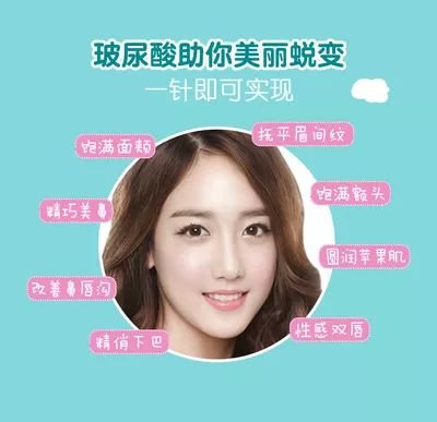 https://img.miyanlife.com/mnt/timg/180725/1254391X9-2.jpg