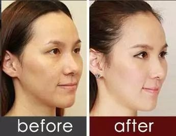 https://img.miyanlife.com/mnt/timg/180725/1254402F3-4.jpg