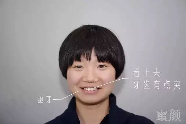 https://img.miyanlife.com/mnt/timg/180725/1303154428-10.jpg