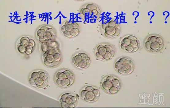 https://img.miyanlife.com/mnt/timg/180725/13142QT5-0.jpg