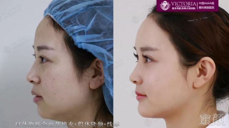 https://img.miyanlife.com/mnt/timg/180725/1321195047-10.jpg