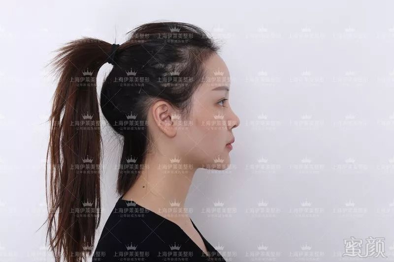 https://img.miyanlife.com/mnt/timg/180725/13214945U-1.jpg
