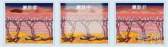 https://img.miyanlife.com/mnt/timg/180725/1322451914-6.jpg