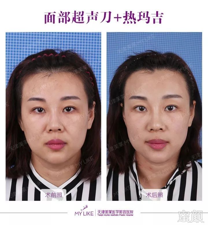 https://img.miyanlife.com/mnt/timg/180725/1354234417-0.jpg