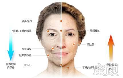 https://img.miyanlife.com/mnt/timg/180725/135425E00-6.jpg