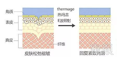 https://img.miyanlife.com/mnt/timg/180725/135502K57-4.jpg