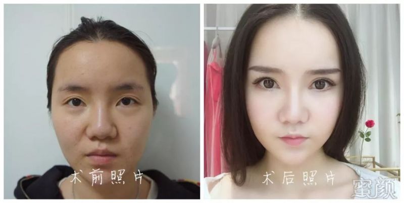 https://img.miyanlife.com/mnt/timg/180725/135Fa118-0.jpg