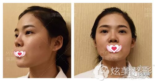 https://img.miyanlife.com/mnt/timg/180725/135HB452-0.jpg