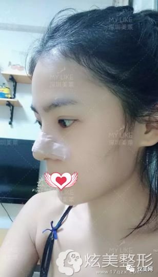 https://img.miyanlife.com/mnt/timg/180725/135HJ1O-4.jpg