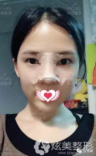 https://img.miyanlife.com/mnt/timg/180725/135HL052-3.jpg