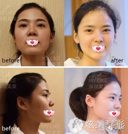 https://img.miyanlife.com/mnt/timg/180725/135HV039-5.jpg
