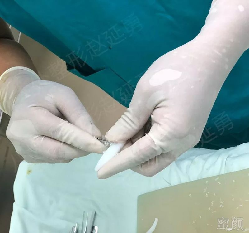 https://img.miyanlife.com/mnt/timg/180726/11491LE2-6.jpg