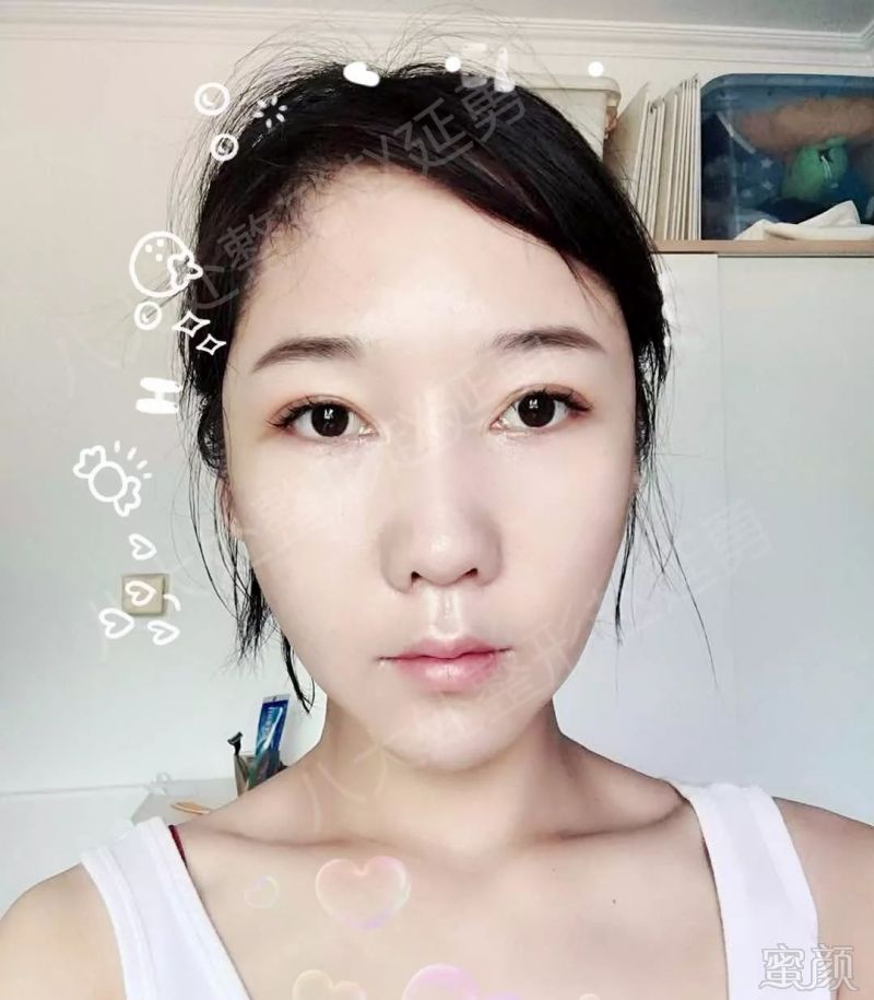 https://img.miyanlife.com/mnt/timg/180726/11492125T-15.jpg