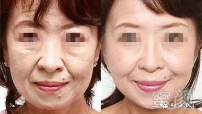 https://img.miyanlife.com/mnt/timg/180726/114SH130-9.jpg