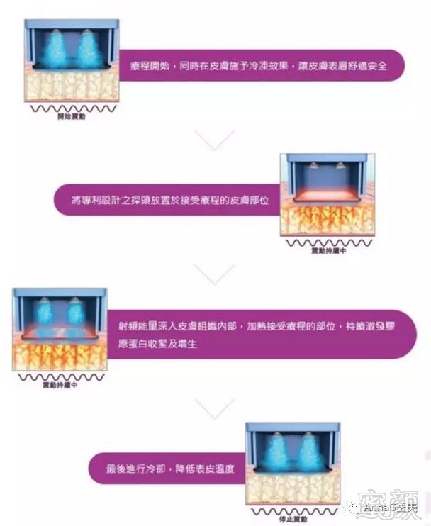 https://img.miyanlife.com/mnt/timg/180726/114SIb9-6.jpg