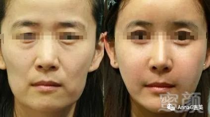 https://img.miyanlife.com/mnt/timg/180726/114SL412-8.jpg