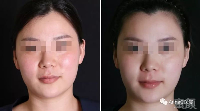 https://img.miyanlife.com/mnt/timg/180726/114SR162-10.jpg