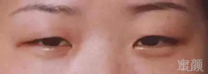 https://img.miyanlife.com/mnt/timg/180726/1156156057-2.jpg