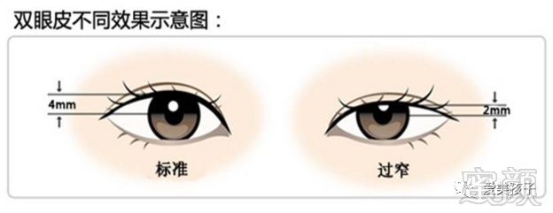 https://img.miyanlife.com/mnt/timg/180726/11593L594-2.jpg