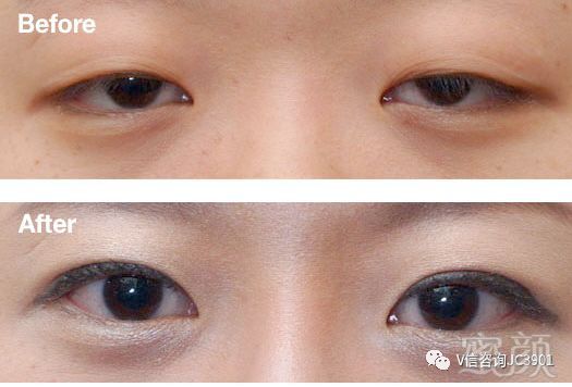 https://img.miyanlife.com/mnt/timg/180726/11594R5A-0.jpg
