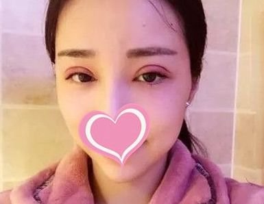https://img.miyanlife.com/mnt/timg/180726/115P23R5-2.jpg