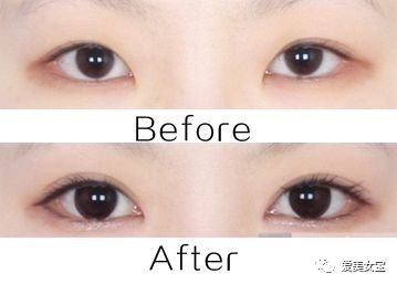 https://img.miyanlife.com/mnt/timg/180726/1205042124-0.jpg