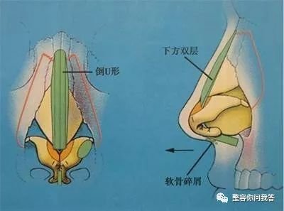 https://img.miyanlife.com/mnt/timg/180726/120I54547-0.jpg