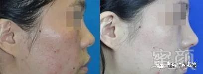 https://img.miyanlife.com/mnt/timg/180726/120I63A9-5.jpg